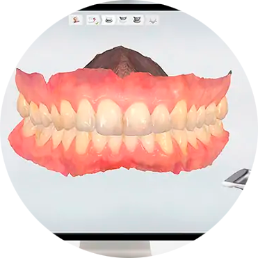 ESCANEO E IMPRESION DE MODELOS