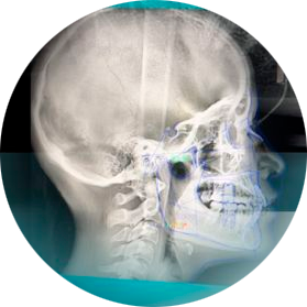 PANORÁMICA Y LATERAL