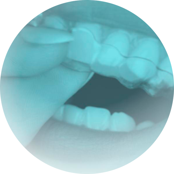 Paquete Ortodoncia Invisible